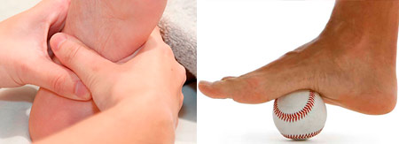 Fascitis plantar, patolog&iacute;s fisioterap&eacute;uticas